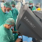 Una cirurgia feta a Girona amb el robot Da Vinci de Clínic Lleida. - CLÍNIC LLEIDA