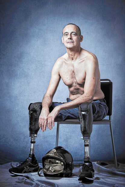 Javier Alonso, El Chispa, bomber a Las Palmas des de 1999. El 2004, va inhalar un bacteri que se li va allotjar al cor. Li van haver d’amputar les dues cames. Reclama el reconeixement de malaltia