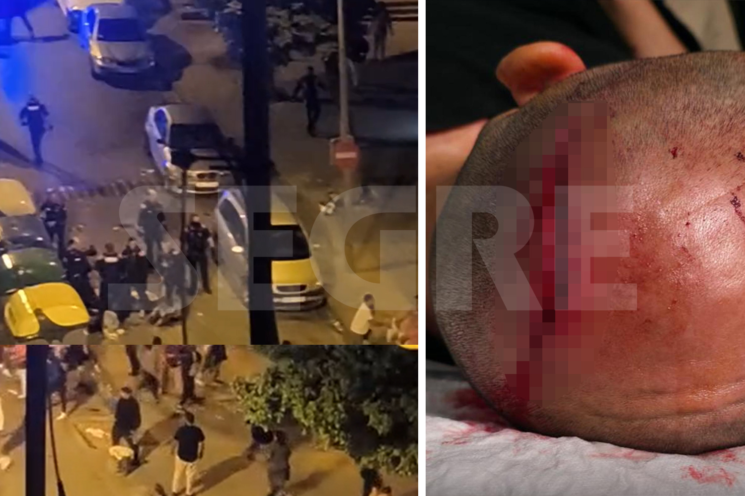 É assim que a cabeça de um dos mussos agredidos no Mariola Turba